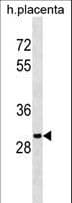 OR5B12 Antibody (aa278-307)