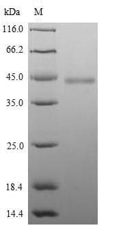 Mouse HAPLN1 Protein (Recombinant 6His, N-terminus)