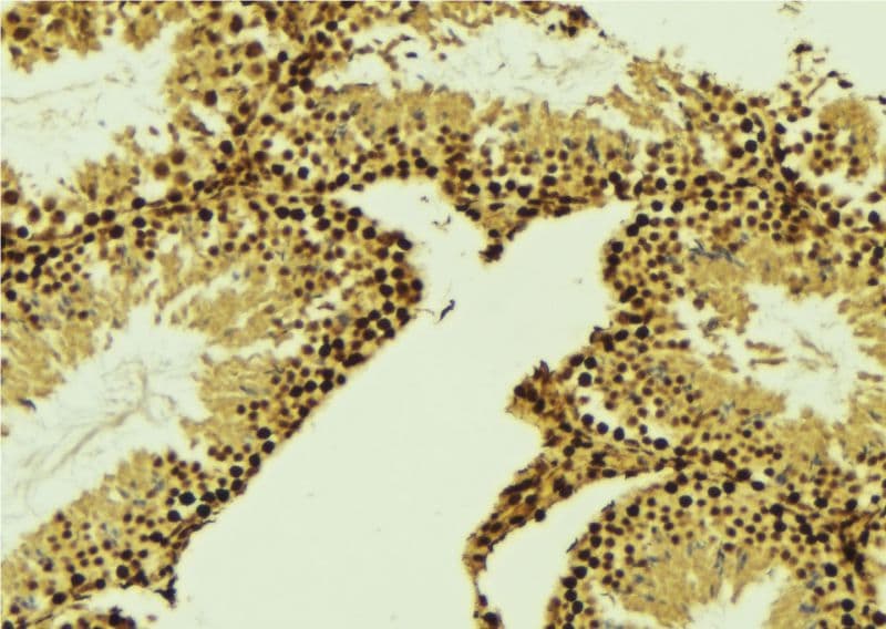 Polyclonal Rabbit anti-Human CCNE2 / Cyclin E2 Antibody (IHC, IF, WB)