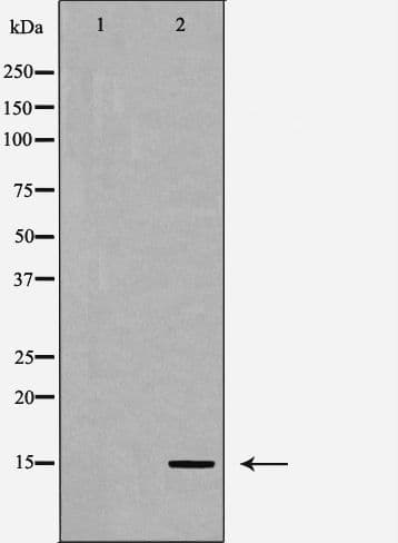 CYB5A / Cytochrome b5 Antibody