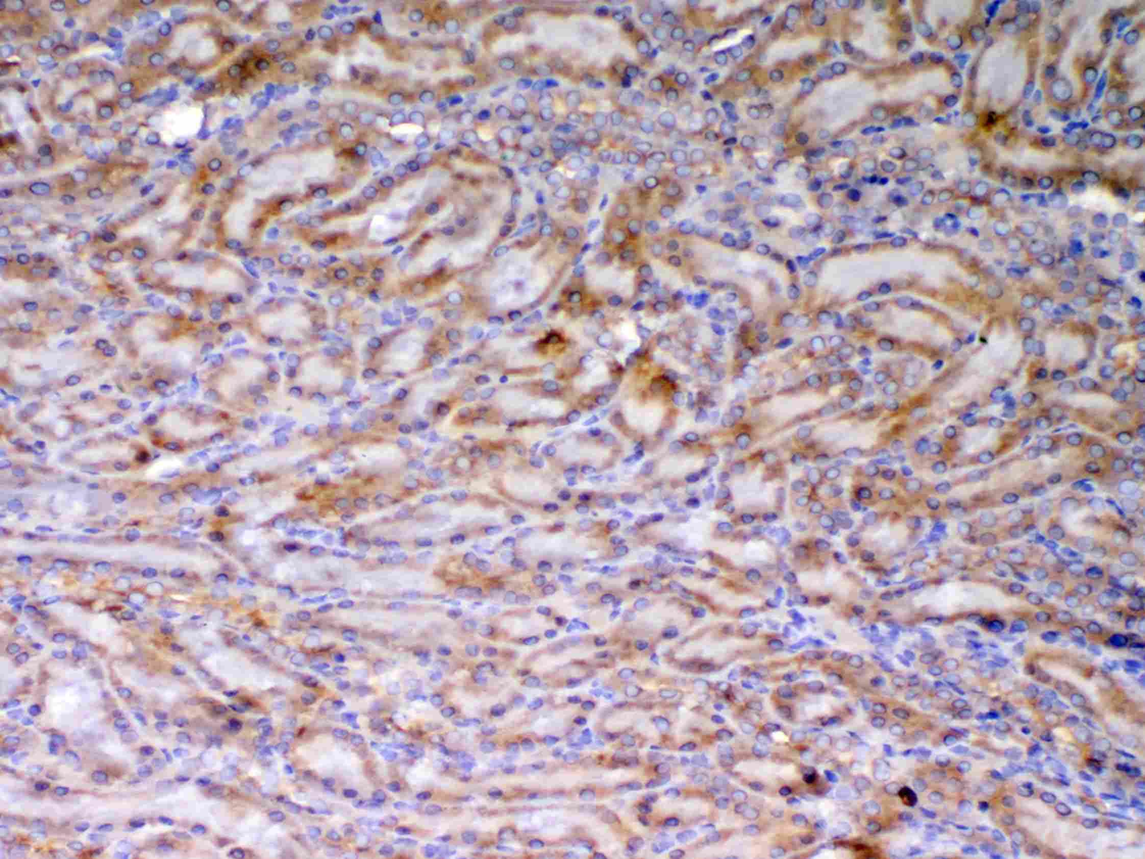 AMD / AMD1 Antibody