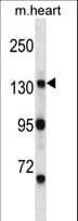 Polyclonal Rabbit anti-Mouse MYO3B Antibody (aa300-329, WB)
