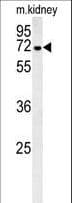 Polyclonal Rabbit anti-Human GLCNE / GNE Antibody (aa580-607, WB)