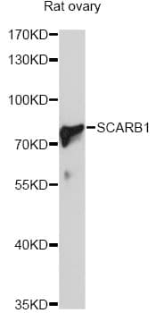 SCARB1 / SR-BI Antibody