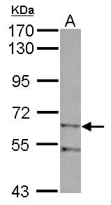 Polyclonal Rabbit anti-Human ZIM2 Antibody (WB)