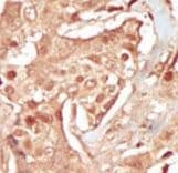 PCTK3 / CDK18 Antibody (aa25-55)