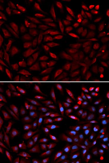 PSMC2 / RPT1 Antibody