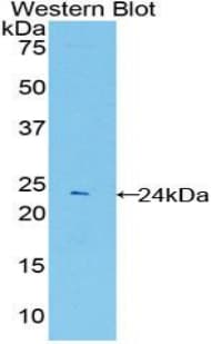 PSMB8 / LMP7 Antibody (aa80-261, Biotin)