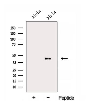 Polyclonal Rabbit anti-Human FA2H / FAAH Antibody (WB)