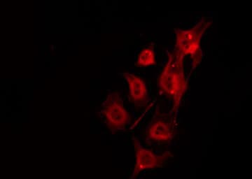 DMPK / DM Antibody