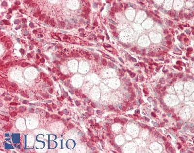 IHC-plus™ ZMYND11 / BS69 Antibody (aa152-180)