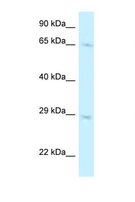 Polyclonal Rabbit anti-Human MUS81 Antibody (aa276-325, WB)