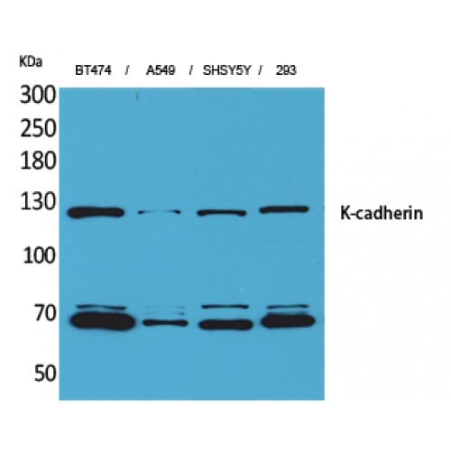 CDH6 / K Cadherin Antibody (180-260 aa, Internal)