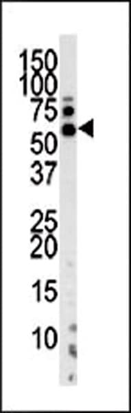 Polyclonal Rabbit anti-Human PINK1 Antibody (aa118-147, IHC, WB)