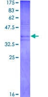 Human PK2 / PROK2 Protein (Recombinant GST, N-terminus)