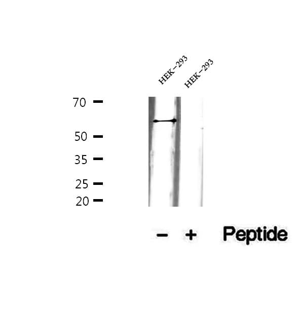 Polyclonal Rabbit anti-Human ARHGEF25 / GEFT Antibody (IHC, WB)
