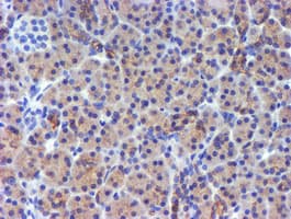 DGKA Antibody (clone OTI7B6)