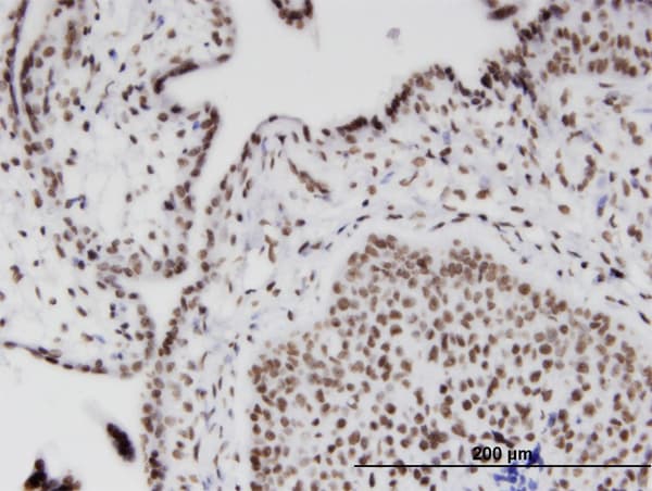RIOK2 Antibody (clone 1B10)