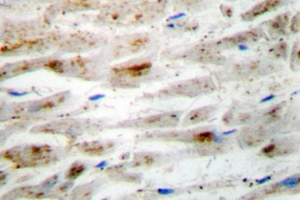 SMAD1 Antibody (phospho-Ser465)