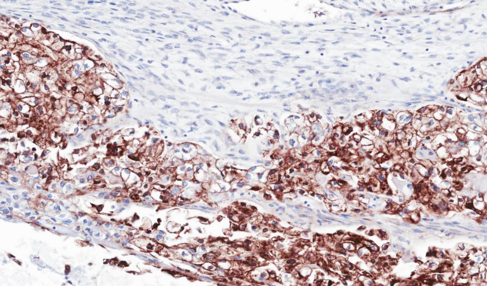 Polyclonal Rabbit anti-Human FLRT1 Antibody (aa35-255, IHC, WB)