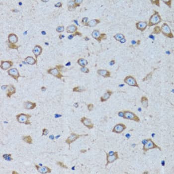 Polyclonal Rabbit anti-Human RARS Antibody (IHC, IF, WB)
