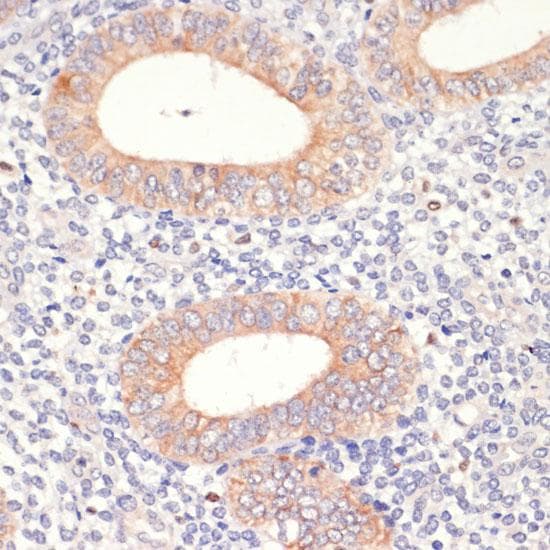 HMG-CoA Reductase / HMGCR Antibody