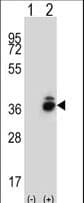 CRHBP Antibody (aa7-36)