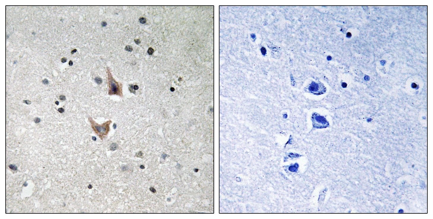 PSEN1 / Presenilin 1 Antibody (phospho-Ser357)