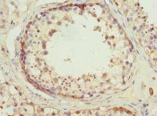 RDH1 / RDH5 Antibody