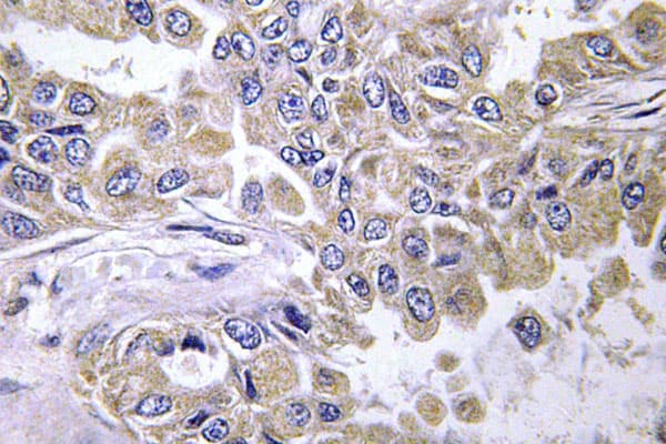 LAMB2 / Laminin Beta 2 Antibody (Cys91)