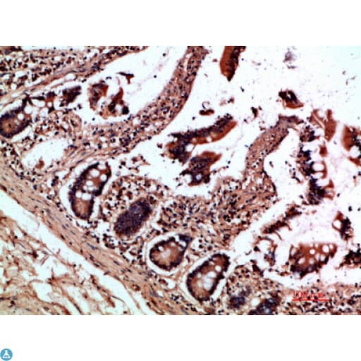 OSM / Oncostatin M Antibody
