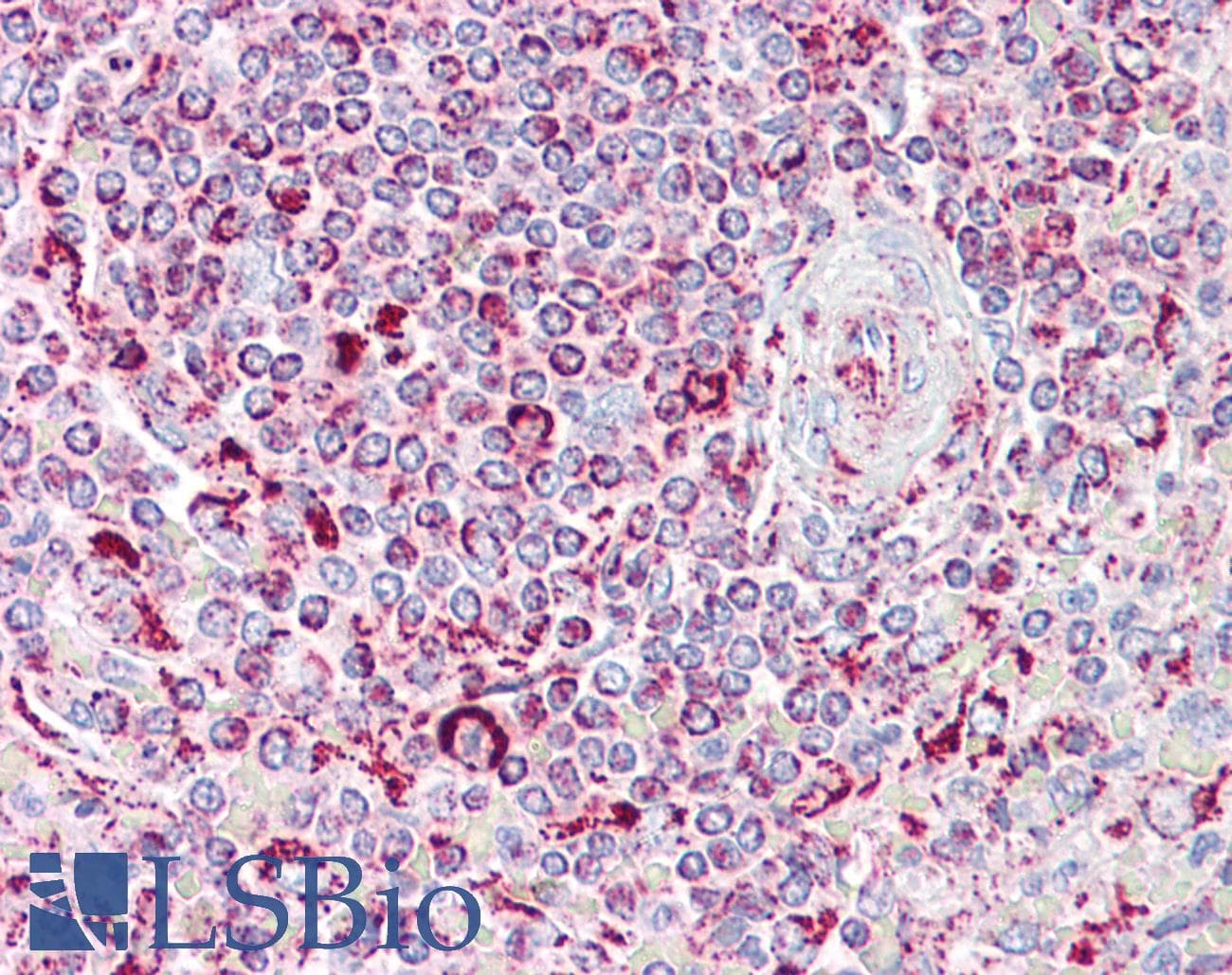 IHC-plus™ TGM5 / Transglutaminase 5 Antibody