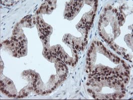 UBE2E3 Antibody (clone OTI7E8)