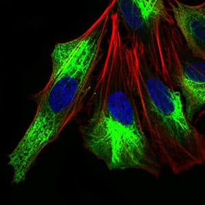 Monoclonal Mouse anti-Human ZEB1 / AREB6 Antibody (clone 2A8A6, aa967-1108, IHC, IF, WB)