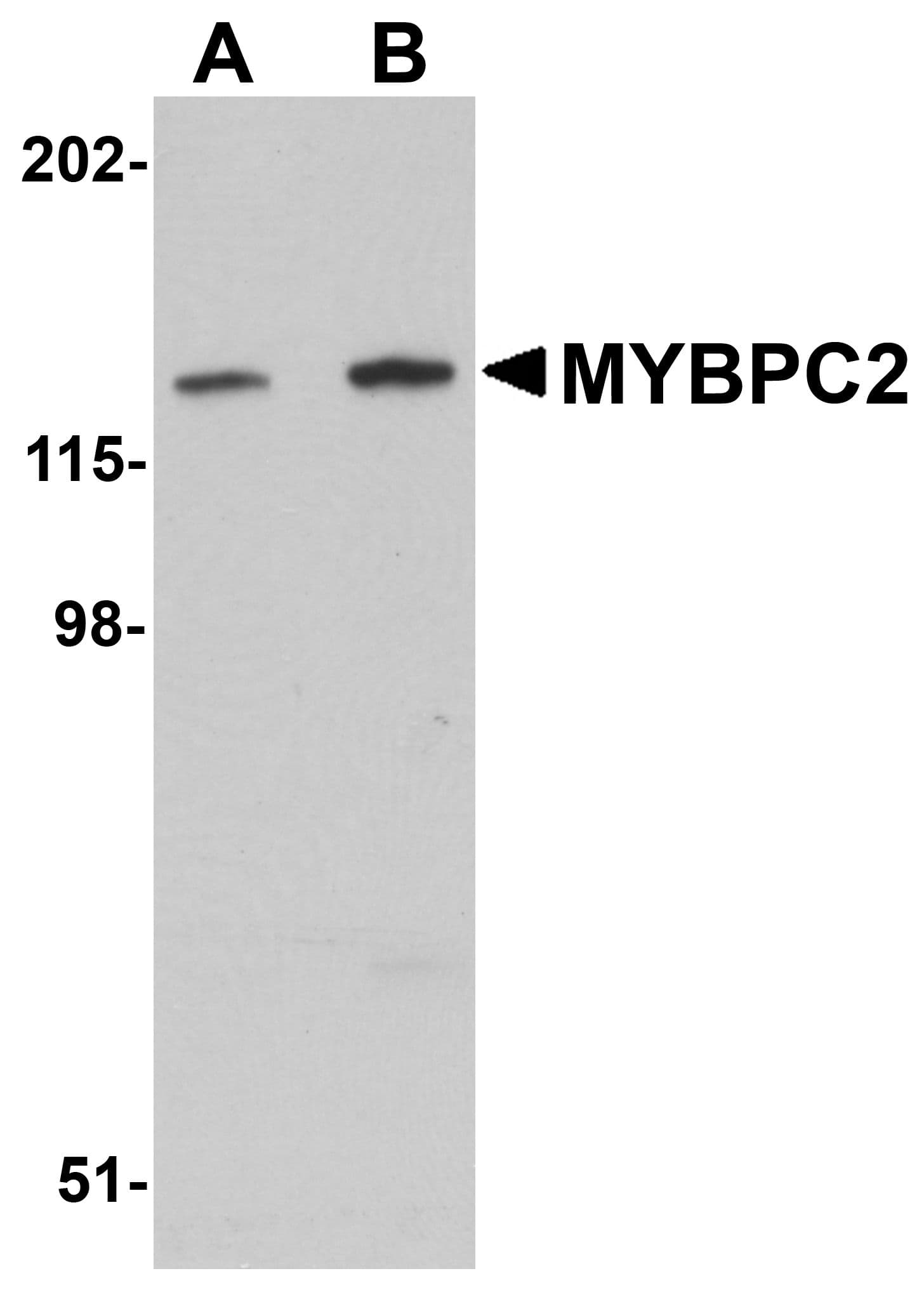 IHC-plus™ Polyclonal Rabbit anti-Human MYBPC2 Antibody (IHC, WB)