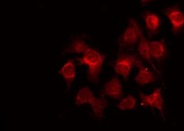 POLR3B Antibody
