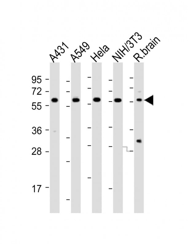 Polyclonal Rabbit anti-Human PICALM / CALM Antibody (aa385-415, WB)