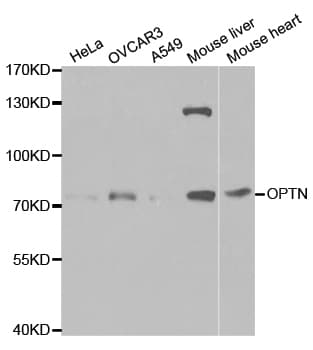 OPTN / Optineurin Antibody
