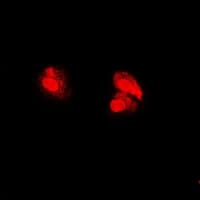 Polyclonal Rabbit anti-Human PSMA5 Antibody (IF, WB)