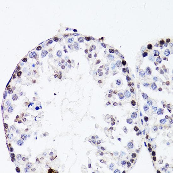 Polyclonal Rabbit anti-Human FGF12 Antibody (IHC)