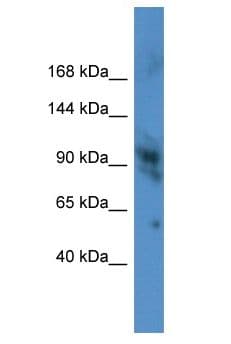 RB1 / Retinoblastoma / RB Antibody (aa621-670)