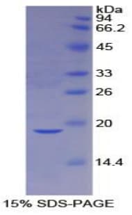 Mouse CASP2 / Caspase 2 Protein (Recombinant His)