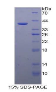 Mouse CCL5 / RANTES Protein (Recombinant His-GST)