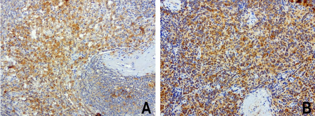 SDCBP / Syntenin Antibody (clone UMAB69, Carrier-free)