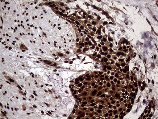 TALDO1 / Transaldolase 1 Antibody (clone OTI2E4)