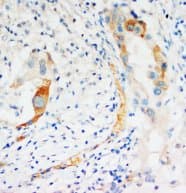 CASP2 / Caspase 2 Antibody (C-Terminus)