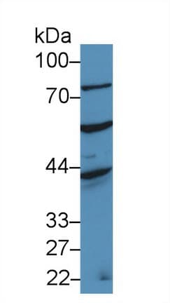 ADAM20 Antibody (aa367-615, PE)