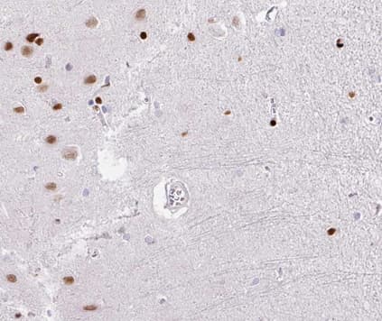 TFDP1 Antibody