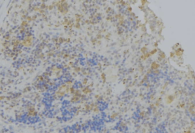 Polyclonal Rabbit anti-Human IL4R / CD124 Antibody (aa105-131, IHC, IF, WB)