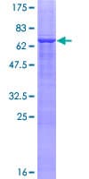 Human ZNF222 Protein (Recombinant GST)